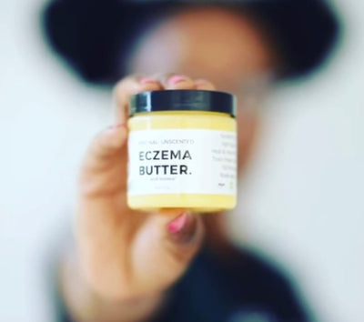 Summertime Eczema Skin Care