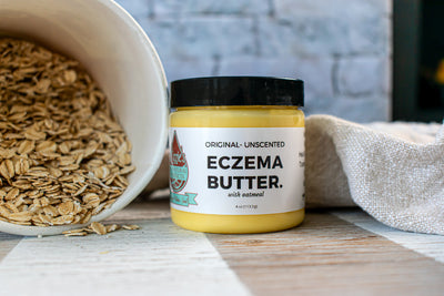 Eczema & Dairy