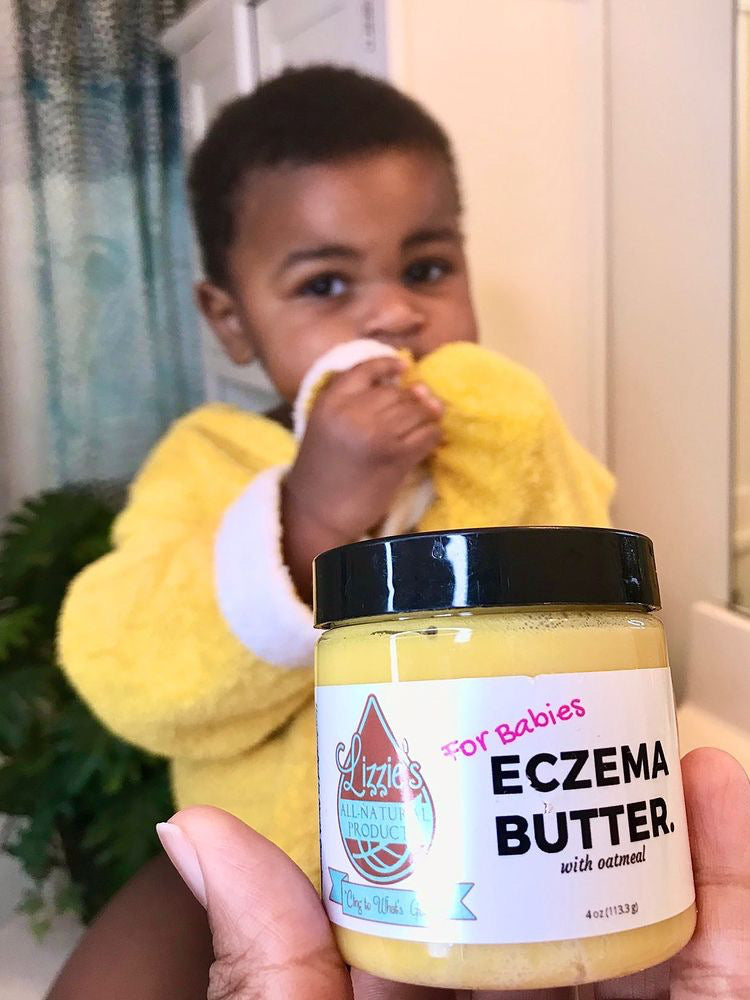Lizzies Eczema Butter Bundle (for babies)